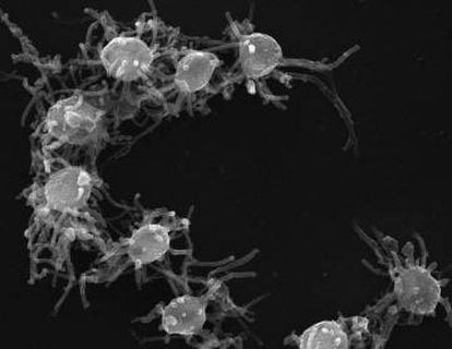 Las amebas, formando un agregado pluricelular