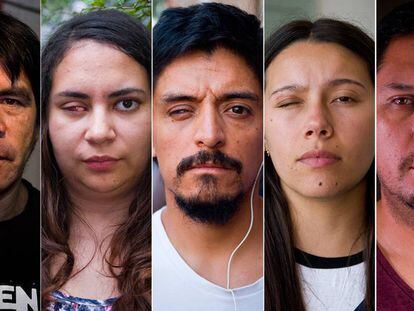 Las víctimas de la violencia policial en Chile