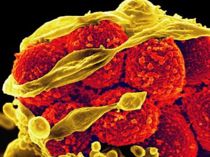 En amarillo, la bacteria &#039;Staphylococcus aureus&#039; escapa de un gl&oacute;bulo blanco