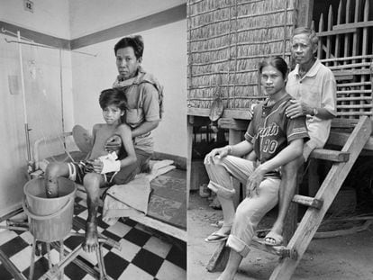 Sokheum Man con 14 años sufrió la amputación de su pierna derecha en 1996. Hoy es un activista contra las minas.