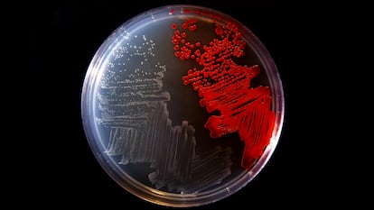 Un cultivo de bacterias en laboratorio.