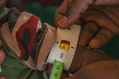 El CRENI del Hospital Poudrière de Niamey asiste a pacientes malnutridos que sufren complicaciones, ya sea malaria, neumonía u otro tipo de afecciones. En los centros de malnutrición severa todos los pequeños son pesados, medidos y analizado su perímetro braquial para observar los niveles de afectación de la malnutrición.