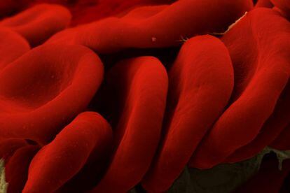 Glóbulos rojos observados con un microscopio electrónico de barrido.