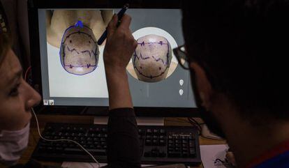 Doctores evalúan a un paciente en una clínica turca.