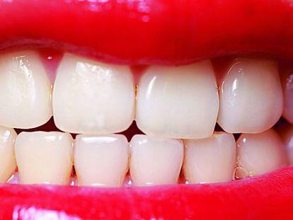 ¿Por qué amarillean los dientes a pesar de cepillarlos a diario?