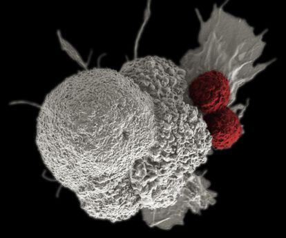 Dos linfocitos T (en rojo) atacan a una célula cancerosa (en blanco).