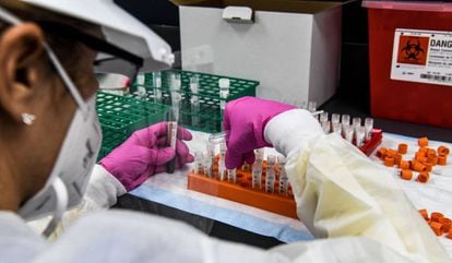 Laboratorio en Florida (EE UU) con muestras de sangre de pruebas de la vacuna para el covid.