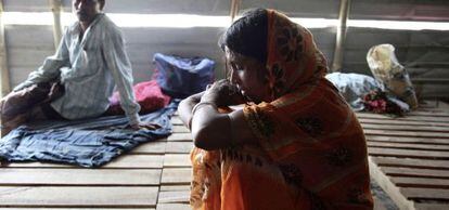 Una fotografía de una mujer quemada con ácido en Bangladesh.