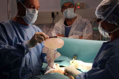 Extracción de un implante de mama en un hospital francés.