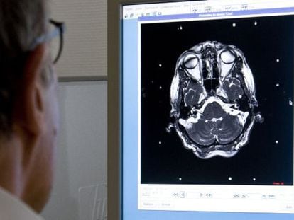 Un médico revisa una prueba diagnóstica del cerebro de un paciente.