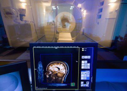 Imagen en 3D de un cerebro en un laboratorio médico.