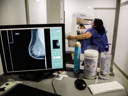 Una trabajadora de la Secretaría de Salud de Ciudad de México realiza una mastografía en una unidad móvil, el pasado 6 de julio.
