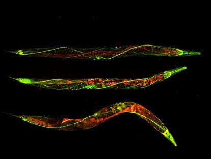El gusano 'C. elegans' tiene un sistema nervioso muy similar al de los seres humanos.