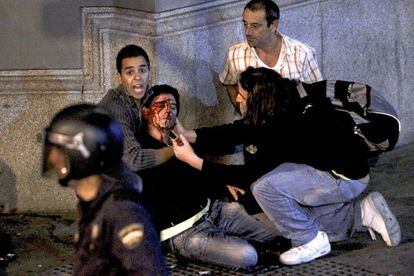 Francisco Javier, despu&eacute;s de haber sido herido en la carga policial del martes.