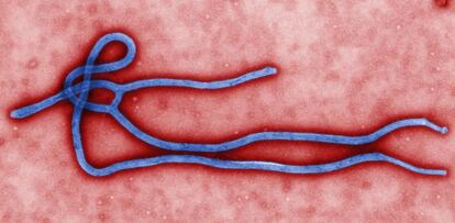 La fotografía del virus del Ébola explica por qué pertenece a la familia de los filovirus: tiene forma de hilo.