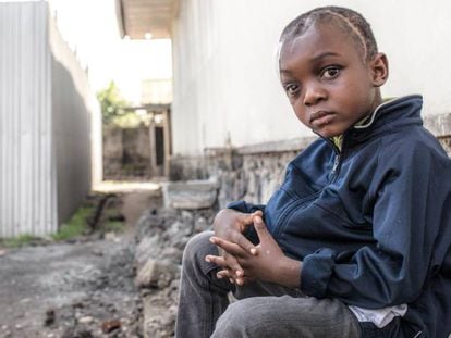 Foto: Davide Kasereka, de cinco años, recibió un disparo en el cráneo en abril de 2018 a manos de un agente de policía ebrio en la ciudad de Goma, capital de la provincia de Kivu de Norte, en el noreste de la República Democrática del Congo (RDC). Vídeo: El infierno más allá de la guerra en Goma (RDC).