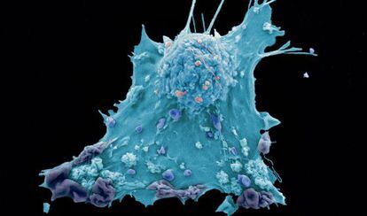 Imagen de una c&eacute;lula cancerosa de mama.