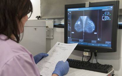 Mamografia realizada en una unidad movil de detección precoz de cáncer de mama.