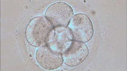 Embri&oacute;n humano en estado de 8 c&eacute;lulas ( 3 d&iacute;as de desarrollo embrionario in vitro)