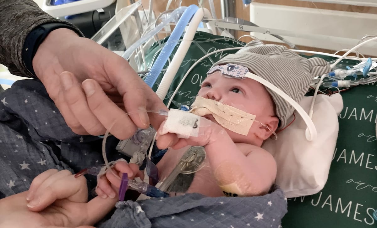 El hito del pequeño Owen: el trozo de corazón trasplantado para curarle un fallo cardíaco crece con él | Salud y bienestar