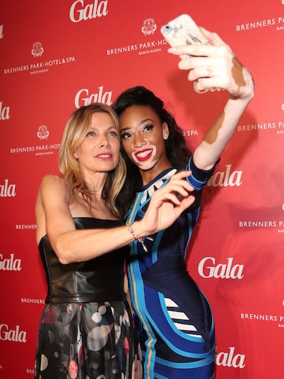 Winnie Harlow. Responsable máxima de la visibilización y normalización del vitiligo, debe su éxito a la también modelo Tyra Banks. Banks dio con ella en Instagram y la seleccionó para participar en su programa America's Next Top Model. Si bien se tuvo que conformar con un sexto puesto, no ha dejado de trabajar desde que terminase el concurso.