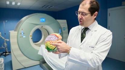Arturo Goicoechea, neurólogo: “Lo que explicamos a los pacientes