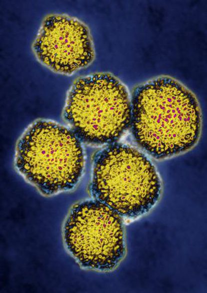 Imágenes obtenidas mediante un microscopio electrónico del virus de la hepatitis C.