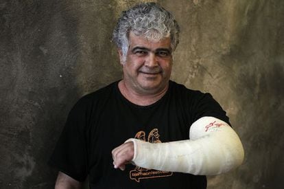 Jaled Jalifa exhibe el brazo que le rompió la policía en una manifestación en Damasco. La foto fue tomada esta semana en Madrid.