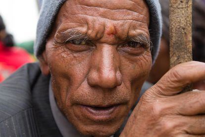 Ganesh Balchur Sirwal, de 64 años, ha llegado con su hija desde el pueblo de Tampal Kot. Las cataratas, muy visible en el ojo derecho, le han impedido ver desde hace un año.
