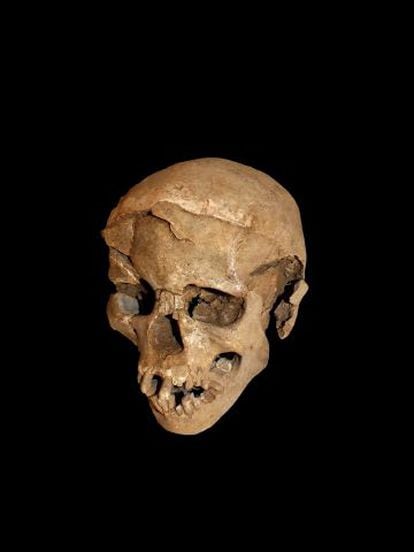 El cráneo de un hombre hallado en Naturuk con múltiples fracturas