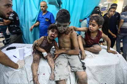 Tres niños heridos son atendidos en el hospital Nasser de Jan Yunis, este miércoles, en la franja de Gaza.