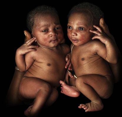 Estas dos niñas fueron vacunadas contra la polio el mismo día en el que nacieron. Lo hicieron en Bougouni, a 45 grados de temperatura ambiente. En estos casos, no solo es fundamental contar con las vacunas, sino que estas se preserven en refrigeradores como el que UNICEF implantó en esta localidad.