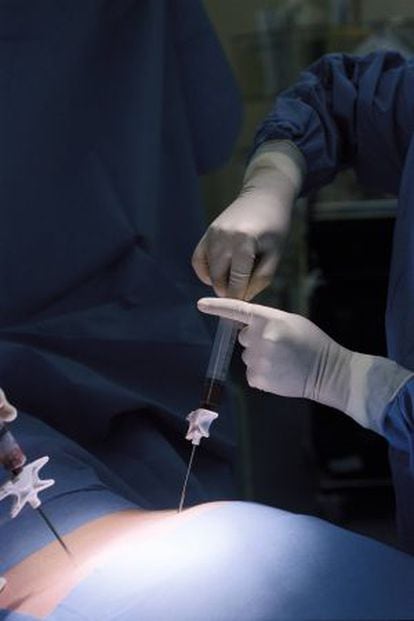 Un cirujano realiza una extracción de médula ósea en el hospital Saint-Louis de Paris.
