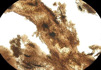 Jasmina Wiemann, paleobióloga molecular del Centro de Investigación Integrativa Negaunee, del Museo Field de Historia Natural (Estados Unidos), quedó finalista de la categoría 'Paleobiología' con esta imagen de un vaso sanguíneo de un dinosaurio rodeado de una matriz extracelular preservada que contiene restos de células de, aproximadamente, 150 millones de años. La investigadora explica que la conservación de los tejidos blandos es gracias a la transformación de las proteínas, los lípidos y los azúcares originales que se produce durante la fosilización.
