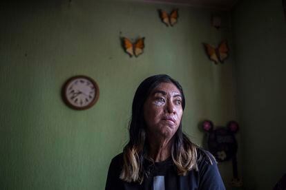 Esmeralda Millán sobrevivió a un ataque con ácido de su expareja hace tres años cuando tenía 23 años.