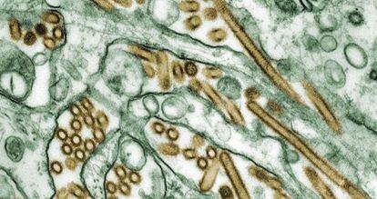 Micrograf&iacute;a del virus de la gripe aviar N5H1 (en color dorado) en un cultivo de c&eacute;lulas (en verde). 