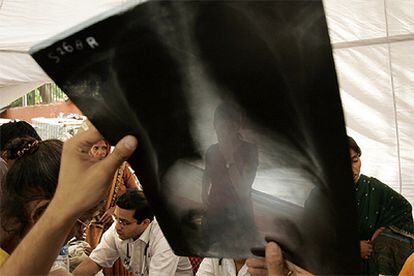 Un paciente examina su radiografía a las puertas de un hospital en huelga de Nueva Delhi.