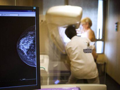 Un técnico realiza una mamografía a una paciente BSIP