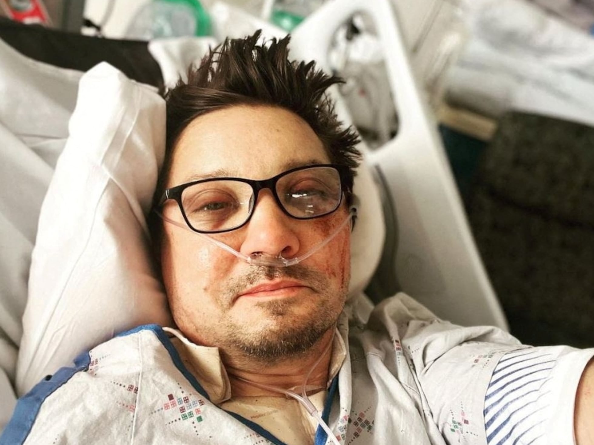 El actor Jeremy Renner publica un selfi desde el hospital para agradecer el  apoyo tras su accidente | Gente | EL PAÍS