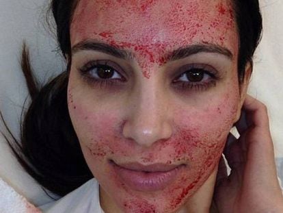 Kim Kardashian es uno de los máximos exponentes a la hora de presumir lo mucho que sufre para estar bella. Aquí, un escalofriante selfie en pleno Vampire Lift