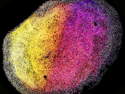 Una imagen de un organoide cerebral completo a partir de tejido fetal humano.