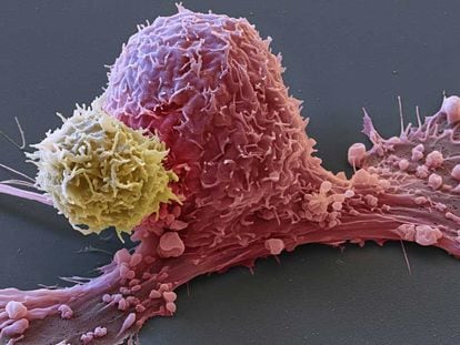 Imagen de una célula tumoral (rosa) atacada por una célula CAR-T (amarillo).