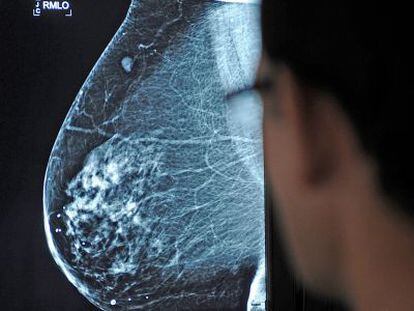 Un médico observa una mamografía en el hospital Virgen del Rocío de Sevilla.
