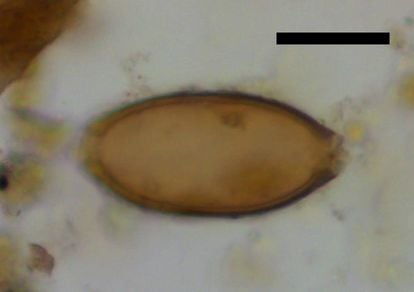 Uno de los huevos de 'Trichuris trichiura' hallados en los coprolitos de Çatalhöyük. La barra negra representa 20 micras.