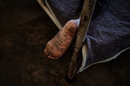 El pie de un recluso dentro de un módulo de aislamiento para pacientes con tuberculosis en la prisión de máxima seguridad de Maputo, este 9 de noviembre. Según un estudio publicado en la revista científica 'The Lancet', la probabilidad de desarrollar tuberculosis en entornos penitenciarios es de seis a 30 veces mayor que en la población general. Benedita José, Jefa del Programa Nacional de Tuberculosis de Mozambique, admite que, mientras que la tasa de incidencia de la tuberculosis en la población general es de 361 por cada 100.000 personas, entre la población penitenciaria es de 1.000 por cada 100.000.