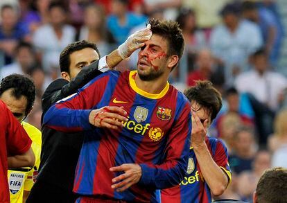 Momento de la lesión en la cabeza de Gerard Piqué durante el encuentro entre Barça y Hércules, en 2010. 