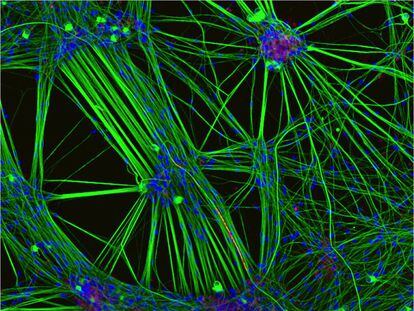 Cultivo de neuronas (en color verde manchadp) derivado de células de piel humana y células de Schwann, un segundo tipo de células cerebrales (manchadas de rojo).