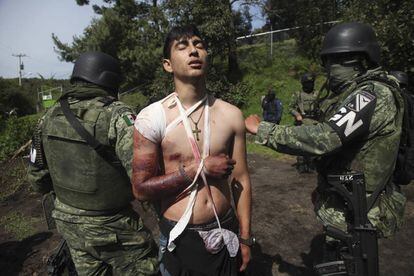 Un herido por una balacera en Michoacán el 3 de septiembre.