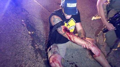 Una persona herida en una manifestación antirracista, en Kenosha (Estados Unidos).
