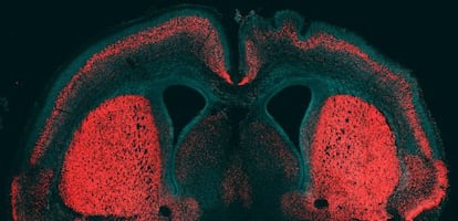 Córtex cerebral de ratón con el gen humano activo en el hemisferio derecho.